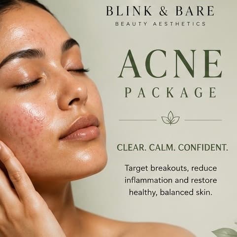 Acne Bootcamp Package at Blink and Bare Beauty Aesthetics in Daytona Beach, FL