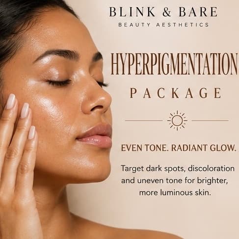 Hyperpigmentation Correction at Blink and Bare Beauty Aesthetics in Daytona Beach, FL